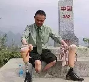 丁曉兵斷臂照片背后的故事與拍攝者揭秘，丁曉兵斷臂照片背后的故事，揭秘拍攝幕后與英雄傳奇